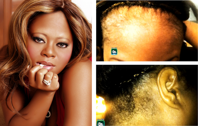 Countess-Vaughn-Reveals-Suffering-From-Scalp-Infections-Due-To-Lace-Wigs