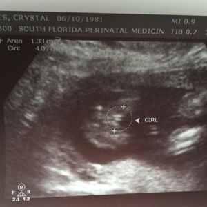 ocho ultrasound